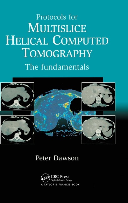 Protocols for Multislice Helical Computed Tomography: The Fundamentals