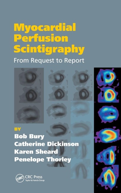Myocardial Perfusion Scintigraphy: From Request to Report