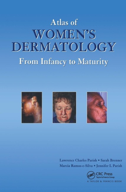 Atlas of Womens Dermatology: From Infancy to Maturity