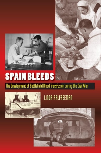 Spain Bleeds The Development of Battlefield Blood Transfusion During the Civil War