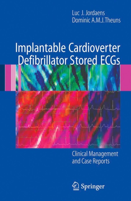 Implantable Cardioverter Defibrillator Stored ECGs: Clinical Management and Case Reports