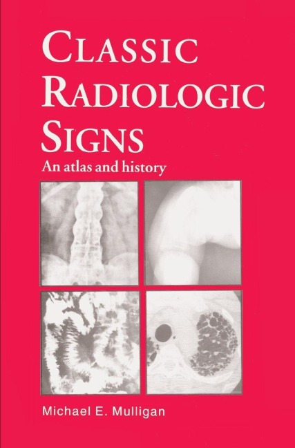 Classic Radiologic Signs: An Atlas and History