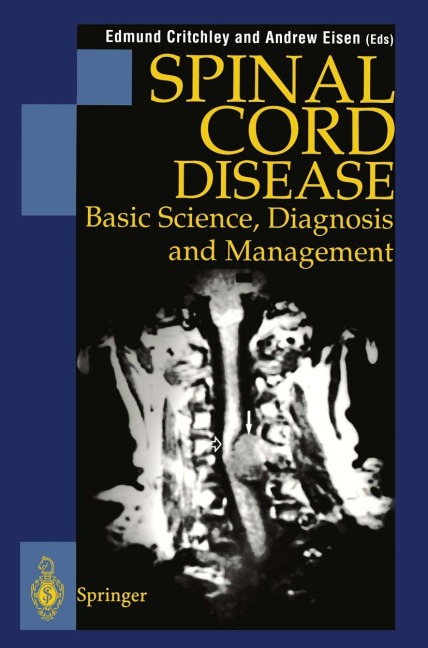 Spinal Cord Disease: Basic Science, Diagnosis and Management