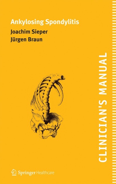 Clinicians Manual on Ankylosing Spondylitis