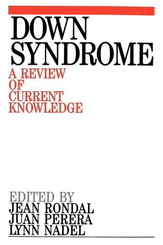 Down Syndrome A Review of Current Knowledge
