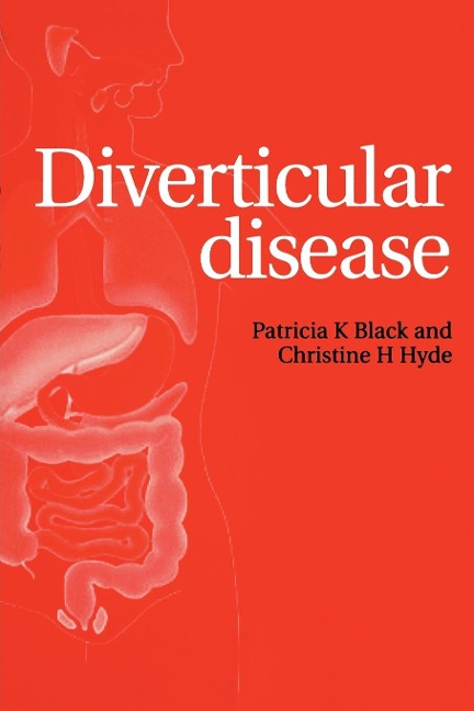 Diverticular Disease