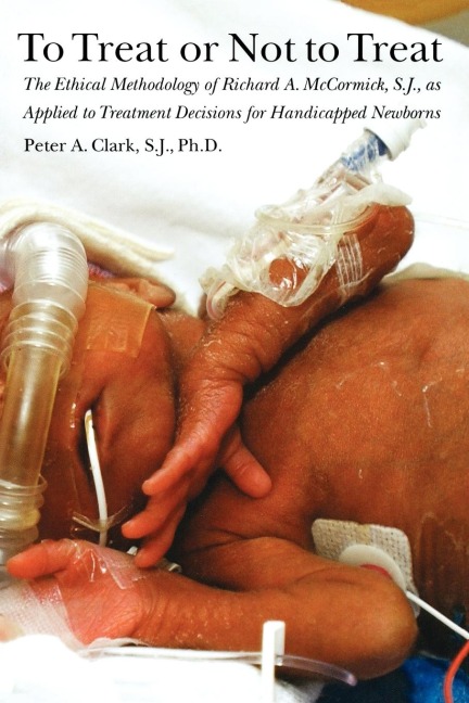 To Treat or Not to Treat: The Ethical Methodology of Richard A. McCormick, S.J., as Applied to Treatment Decisions for Handicapped Newborns