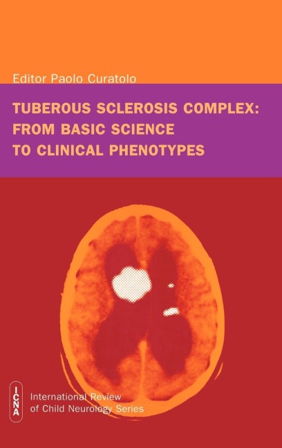 Tuberous sclerosis complex: from basic science to clinical phenotypes