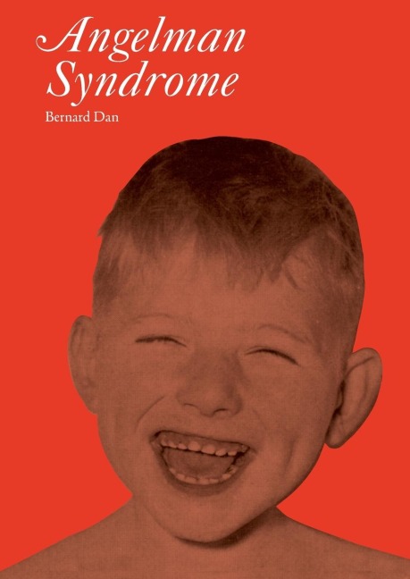 Angelman Syndrome