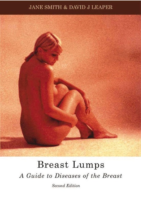 Breast Lumps: A Guide to Diseases of the Breast