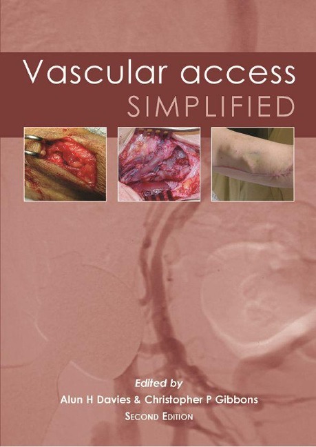 Vascular Access Simplified; Second Edition