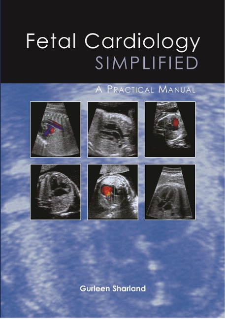 Fetal Cardiology Simplified: A Practical Manual