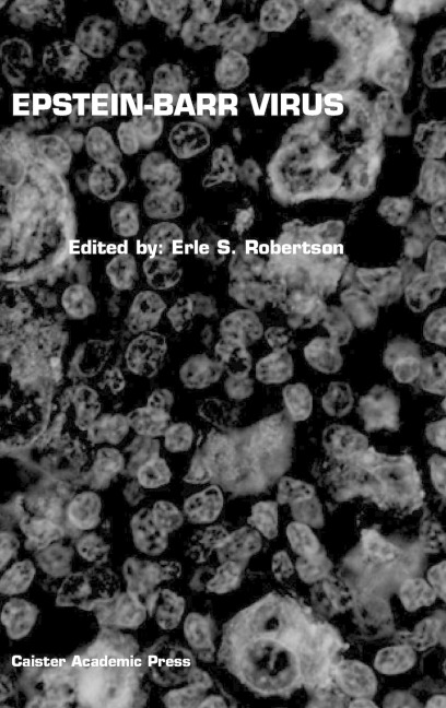 Epstein-Barr Virus