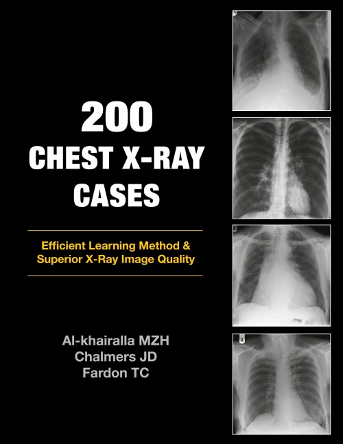 200 Chest X-Ray Cases
