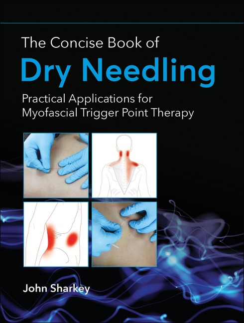 The Concise Book of Dry Needling: Practical Applications for Myofascial Trigger Point Therapy