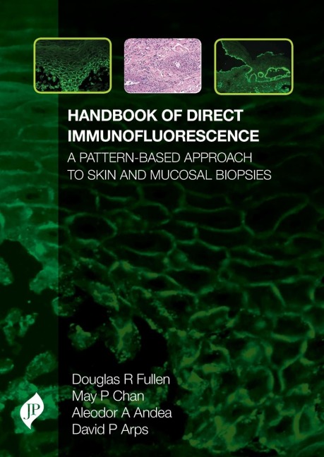 Handbook of Direct Immunofluorescence: A Pattern-Based Approach to Skin and Mucosal Biopsies