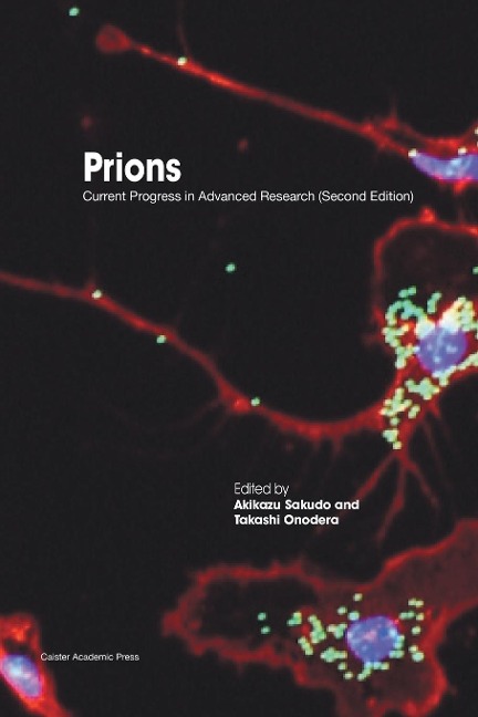 Prions: Current Progress in Advanced Research (Second Edition)