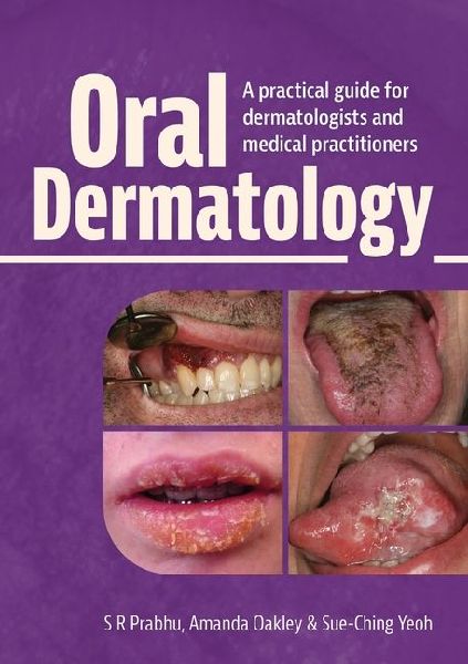 Oral Dermatology
