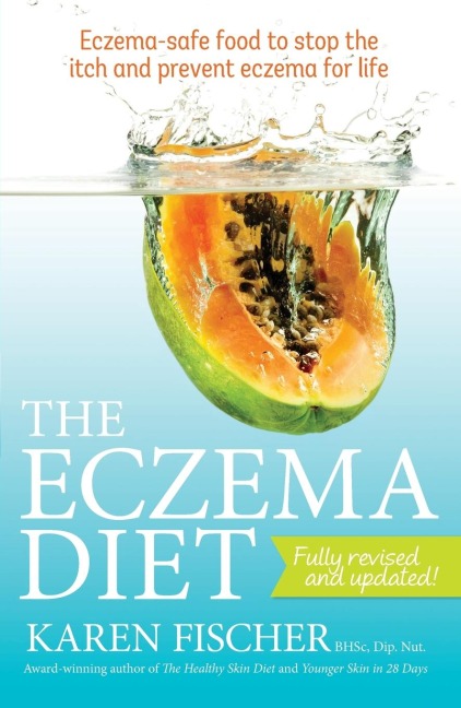 The Eczema Diet: Eczema-safe food to stop the itch and prevent eczema for life