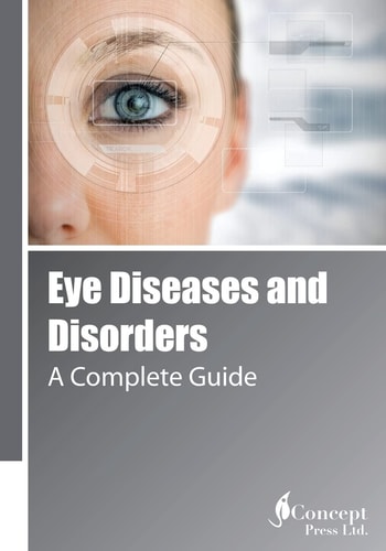 Eye Diseases and Disorders A Complete Guide
