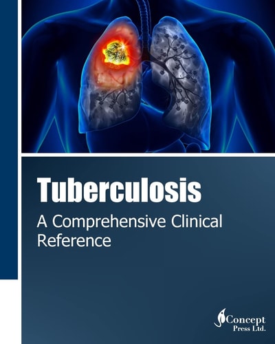 Tuberculosis A Comprehensive Clinical Reference