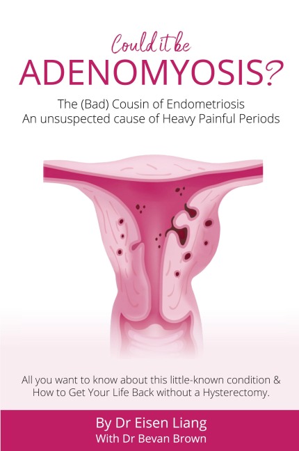 Adenomyosis -The Bad Cousin of Endometriosis: An unsuspected cause of Heavy Painful Periods