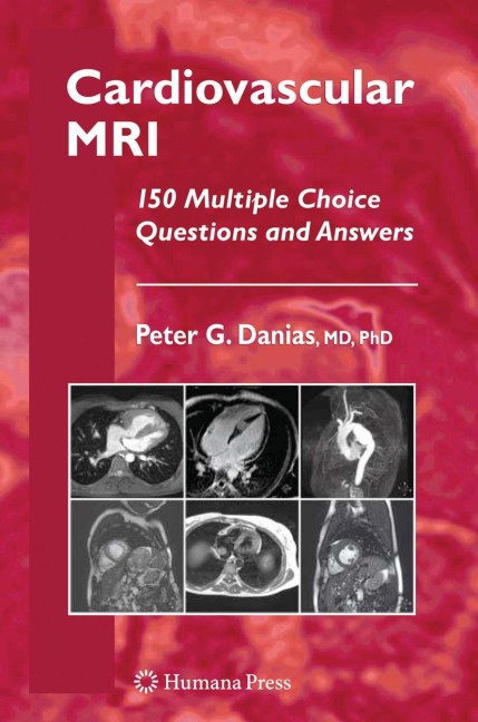 Cardiovascular MRI: 150 Multiple-Choice Questions and Answers