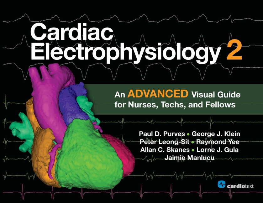 Cardiac Electrophysiology 2: An Advanced Visual Guide for Nurses, Techs, and Fellows: An Advanced Visual Guide for Nurses, Techs, and Fellows
