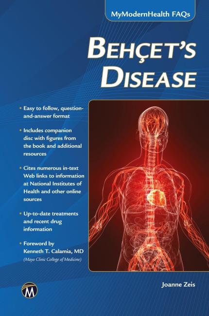 Behcets Disease
