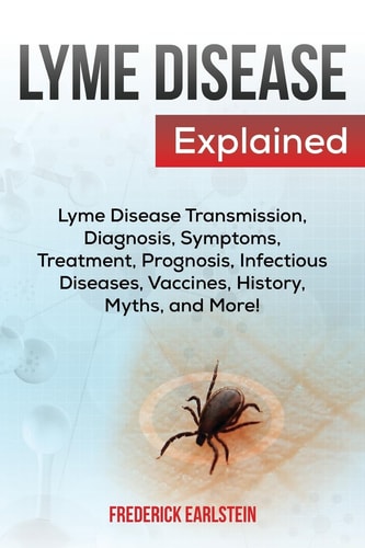 Lyme Disease Explained Lyme Disease Transmission, Diagnosis, Symptoms, Treatment, Prognosis, Infectious Diseases, Vaccines, History, Myths, and More!
