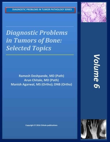 Diagnostic Problems in Tumors of Bone Selected Topics