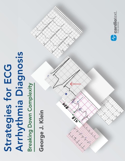 Strategies for ECG Arrhythmia Diagnosis: Breaking Down Comlexity : Breaking Down Complexity