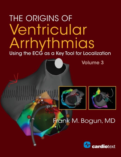 The Origins of Ventricular Arrhythmias: Using the ECG as a Key Tool for Localization, Volume 3