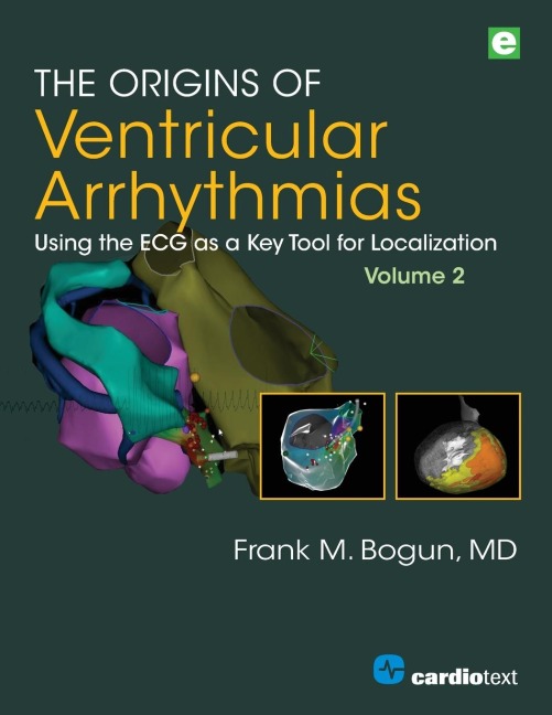 The Origins of Ventricular Arrhythmias, Volume 2: Using the ECG as a Key Tool for Localization, Volume 2