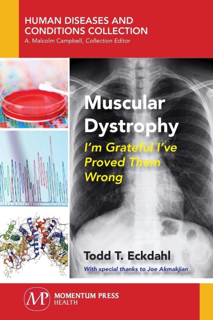 Muscular Dystrophy: Im Grateful Ive Proved Them Wrong