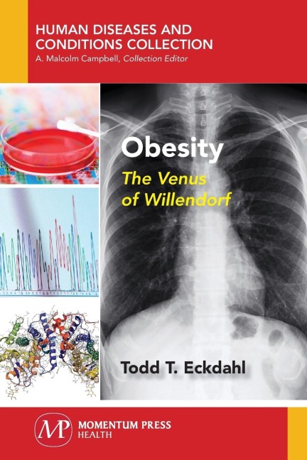 Obesity: The Venus of Willendorf