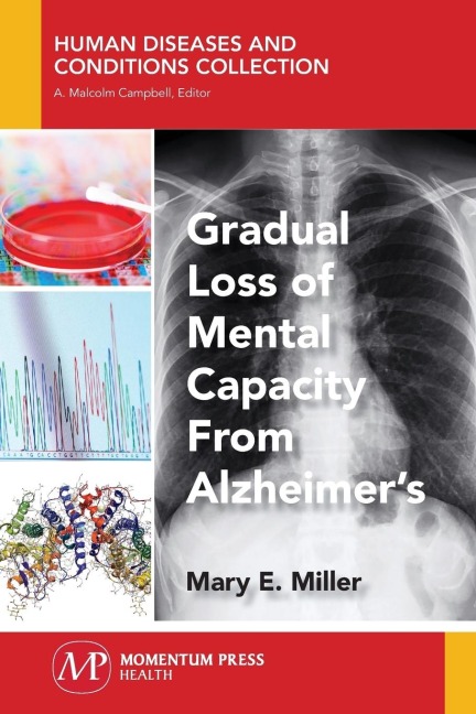 Gradual Loss of Mental Capacity from Alzheimers