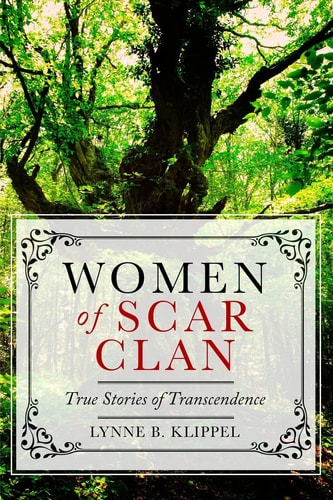 Women of Scar Clan True Stories of Transcendence