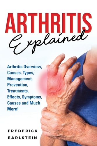 Arthritis Explained Arthritis Overview, Causes, Types, Management, Prevention, Treatments, Effects, Symptoms, Causes and Much More!