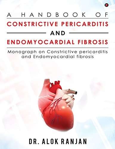 A Handbook of Constrictive Pericarditis and Endomyocardial Fibrosis Monograph on Constrictive Pericarditis and Endomyocardial Fibrosis