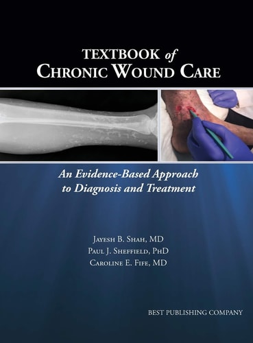 Textbook of Chronic Wound Care An Evidence-based Approach to Diagnosis and Treatment