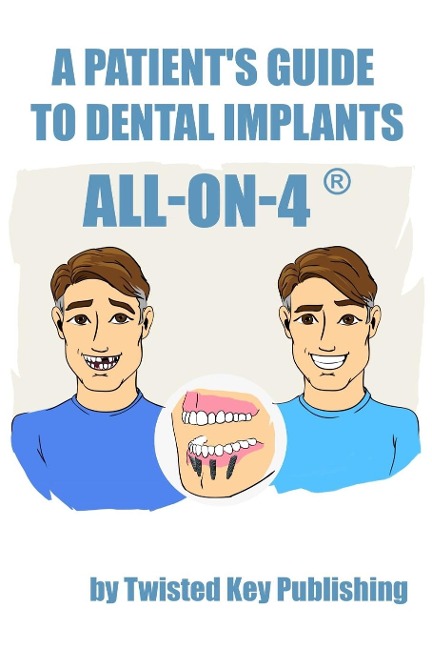 A Patients Guide to Dental Implants: All-on-4