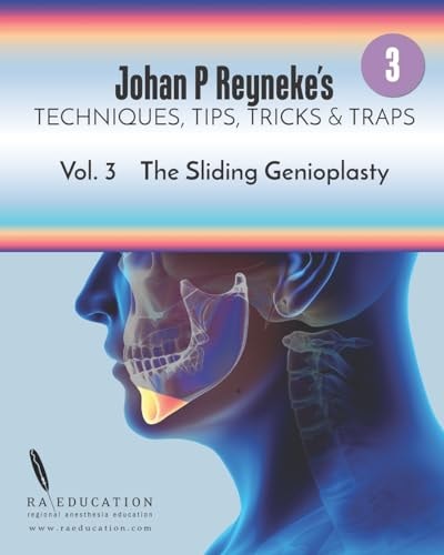 Johan P. Reyneke's Techniques, Tips, Tricks and Traps Vol 3 The Sliding Genioplasty