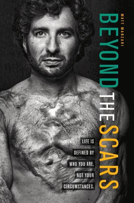 Beyond the Scars: Life Is Defined by Who You Are, Not Your Circumstances