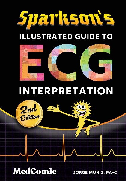 Sparksons Illustrated Guide to ECG Interpretation
