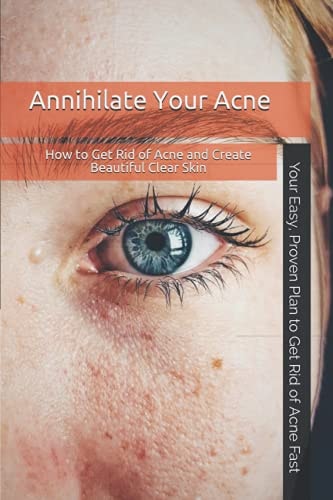 Annihilate Your Acne How to Get Rid of Acne and Create Beautiful, Clear Skin; Your Easy, Proven Plan to Get Rid of Acne Fast