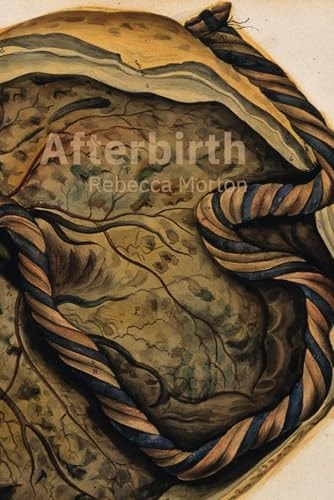 Afterbirth