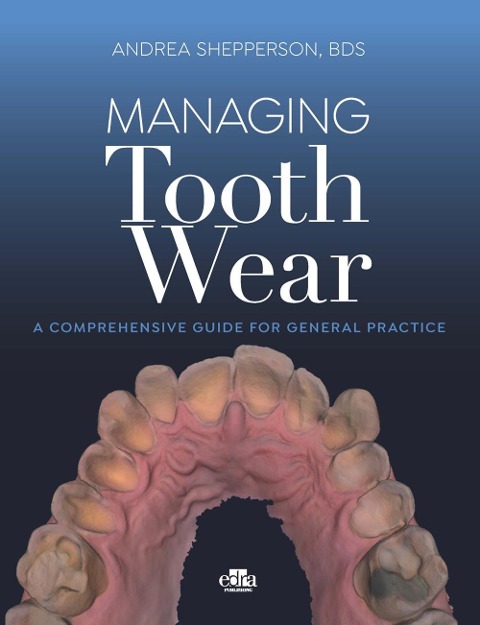 Managing Tooth Wear (C) / Shepperson
