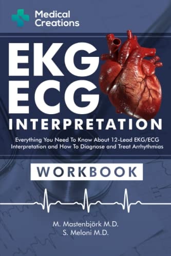 EKG/ECG Interpretation Everything You Need to Know about the 12 - Lead ECG/EKG Interpretation and How to Diagnose and Treat Arrhythmias: Workbook