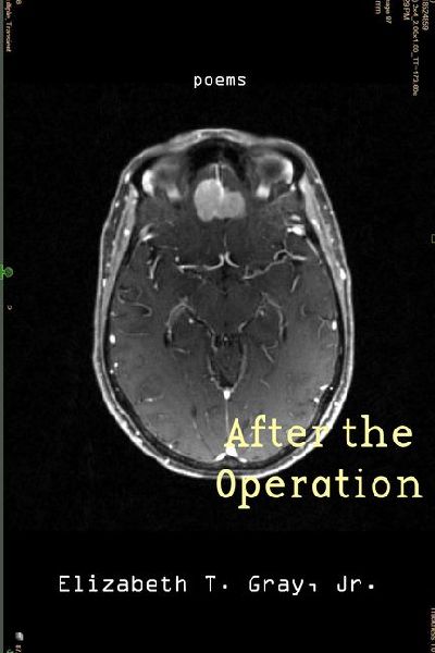 After the Operation